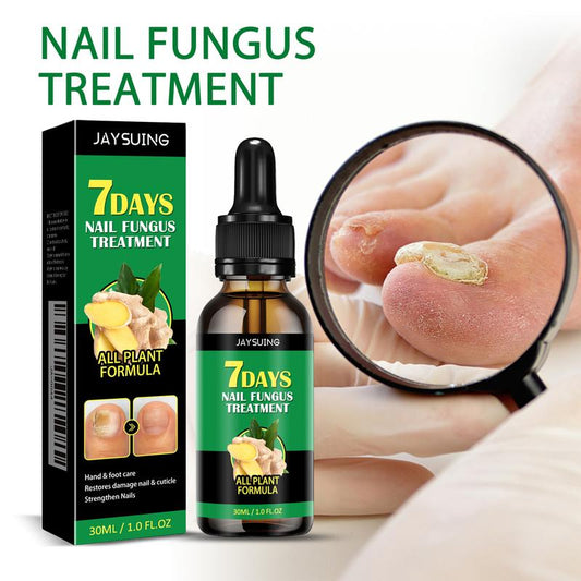 2025-Best Seller-LOVILDS™ Ginger Nail Treatment with Vitamin E & Essential Oils